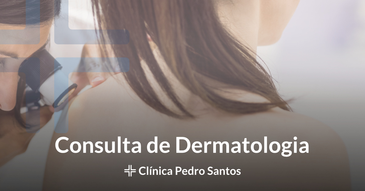 Consulta de Dermatologia